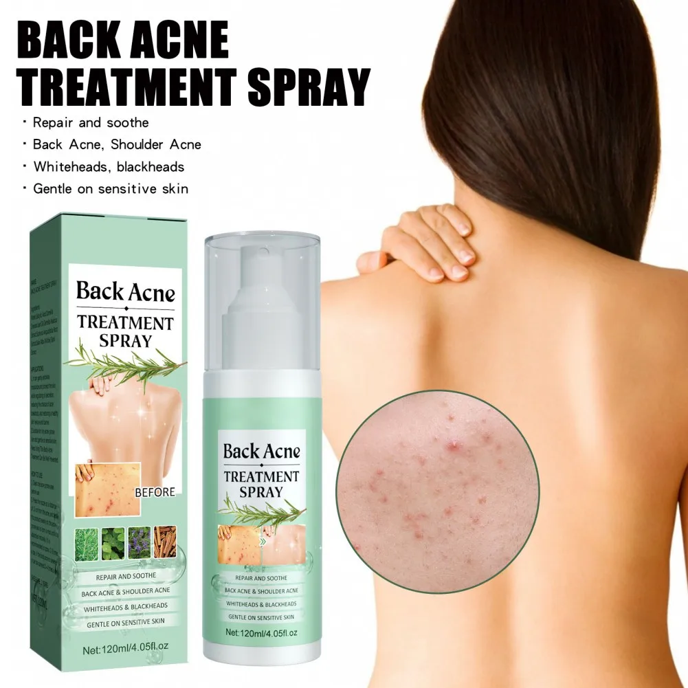 120ml Back Acne Treatment Body Spray Chest Solution Herbal Formula Beauty Health Smooth Safe Oil Control Exfoliating Moisturizer