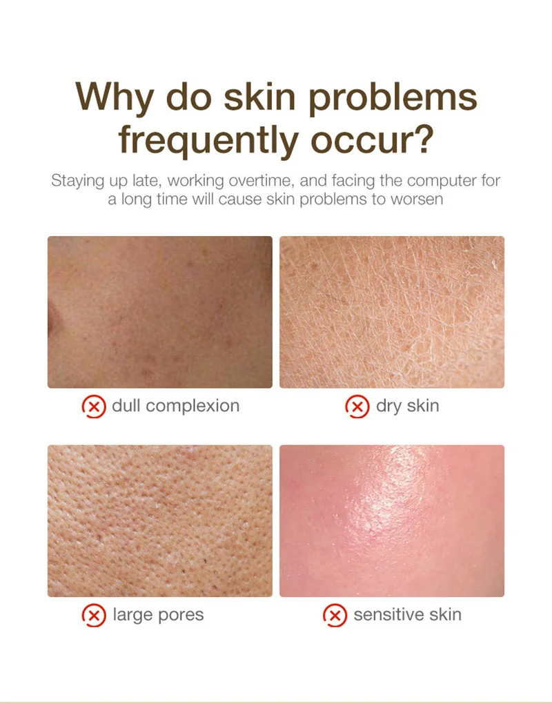 米と蜂蜜のクレンジングフェイスマスク、ブライトニング美容液、化粧水、保湿ブライトニングオイルコントロールギフトセット、女性用スキンケア、韓国製