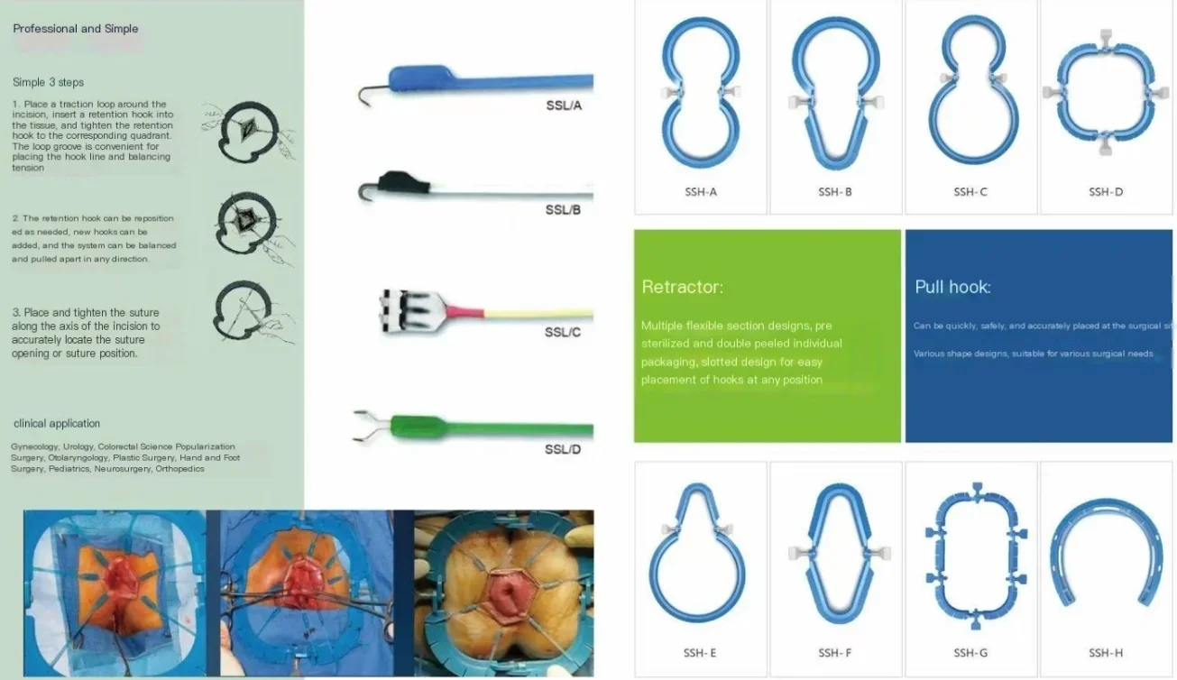 

Surgical Abdominal Retractor Rectal Retractor Ring Lonestar Retractor with Hooks 8 Models in stock