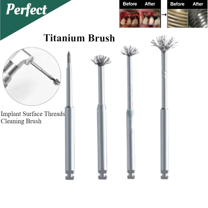 

Dental Debridement Peri-Implantitis Implant Surface Threads Titanium Brush for Implant Restoration Maintenance Autoclavable