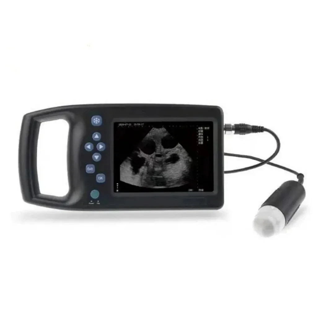 

Zetop Medica 5.7-inch Farm Use Livestock Veterinary Ultrasound Scanners