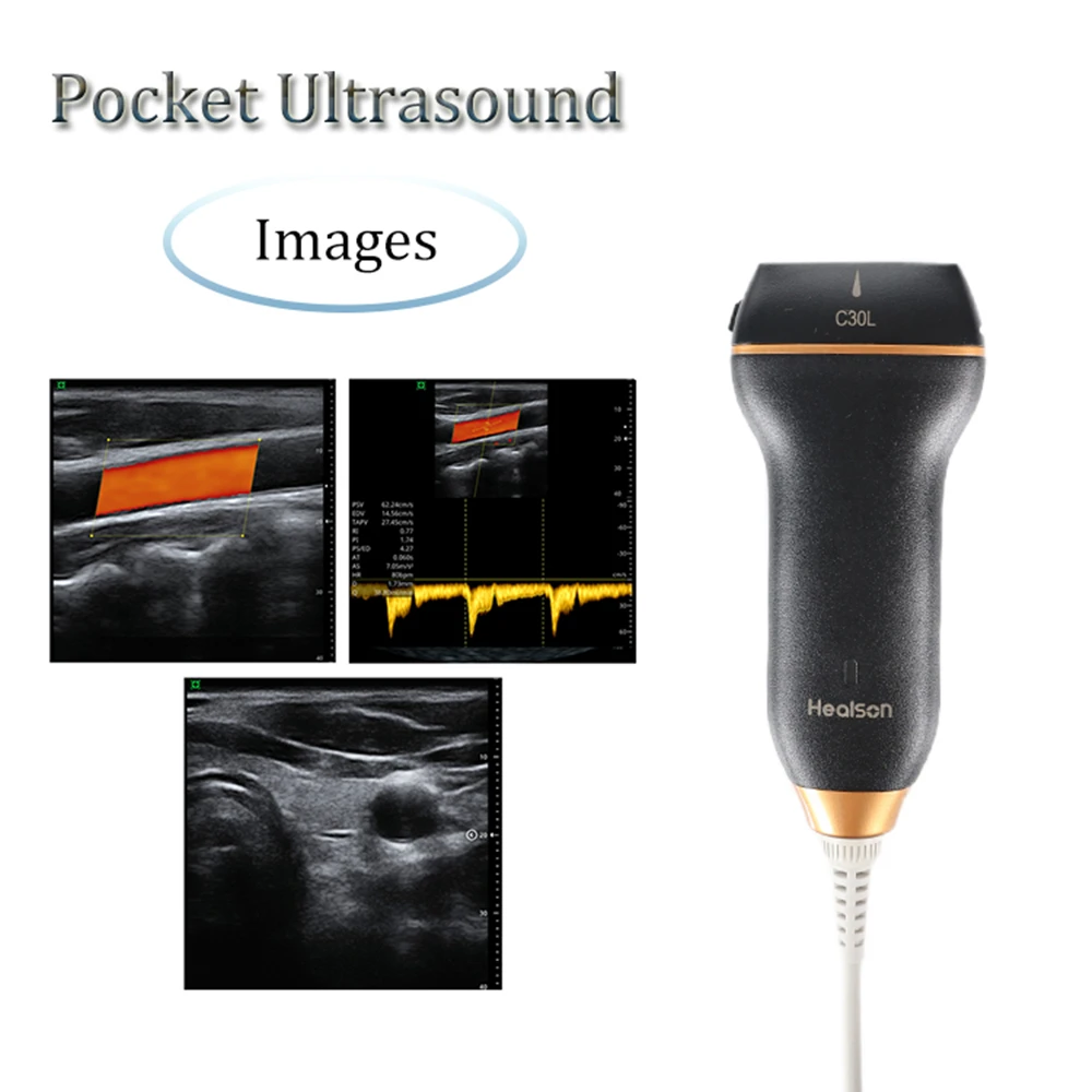 

Healson C30L Handheld Pocket Linear USG Color Doppler Portable Ultrasound for Breast, MSK, Lung, Superficial, Vascular, Thyroid
