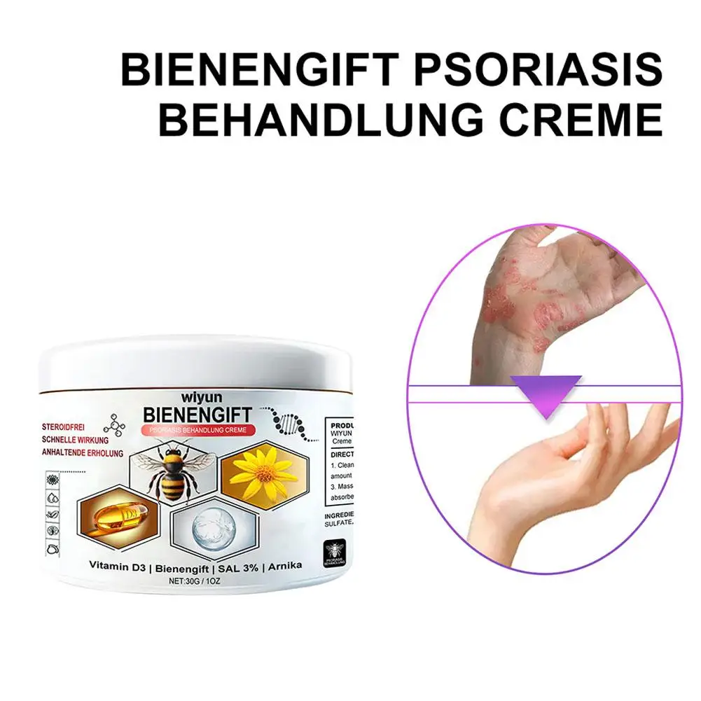 30g Bee Venoms Joint Care Cream Relieve Cervical Joint Soreness Massage Treatments Cream Bone Health Body Care Tools