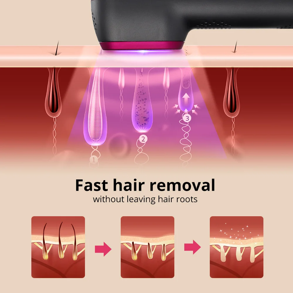 Lidar com tipo instrumento de remoção de pêlos a laser de corpo inteiro de 5 velocidades IPL luz de pulso suave