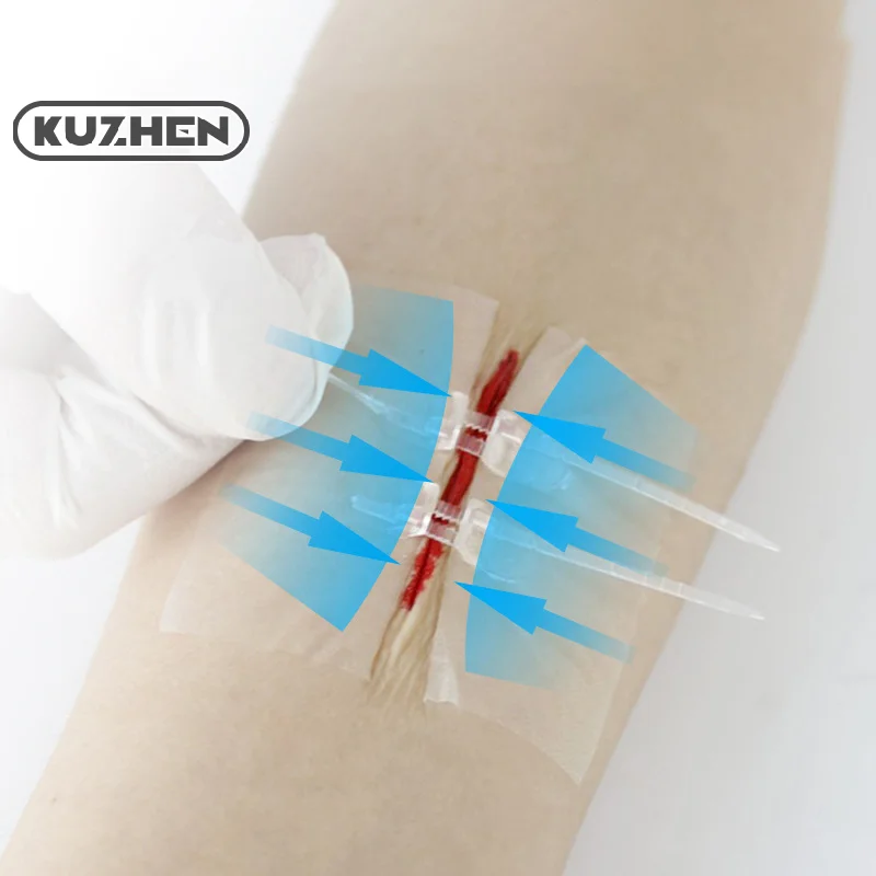 1/2Pcs Zipper Tie Wound Closure Patch Hemostatic Patch Wound Fast Suture Zipper Band-Aid Outdoor Portable