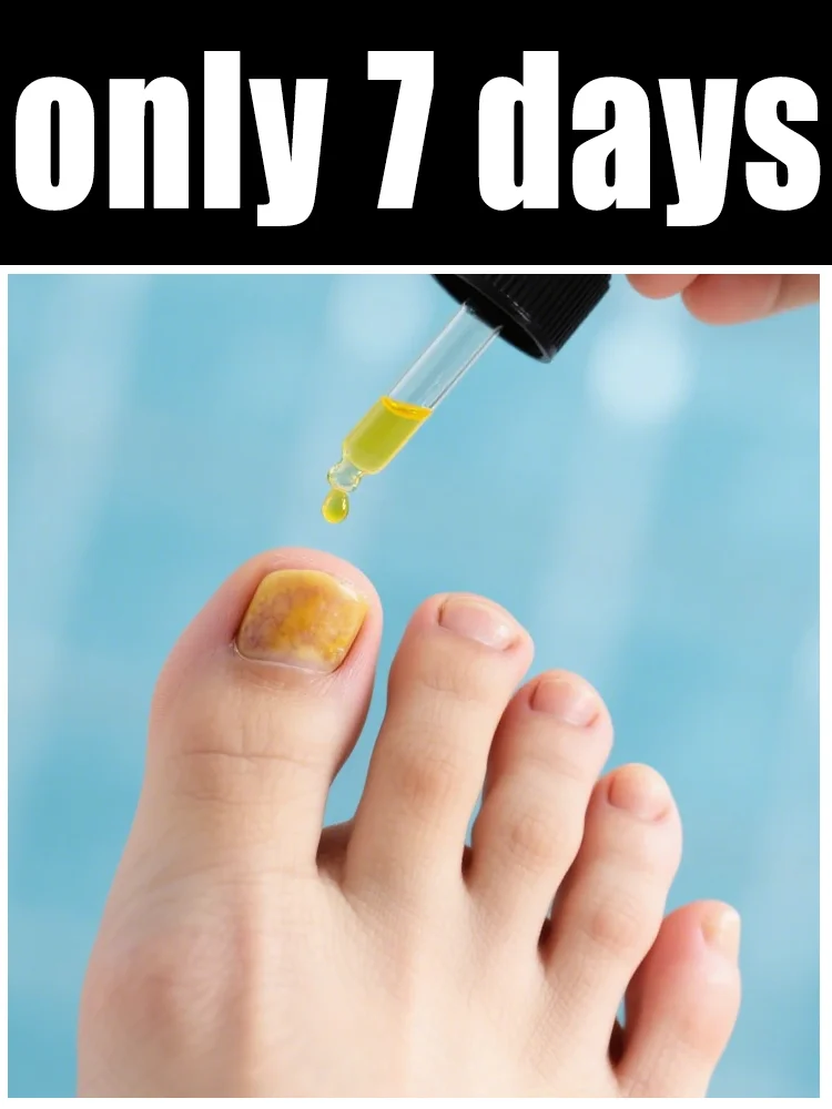 

Quickly eliminate fungus and restore healthy nails