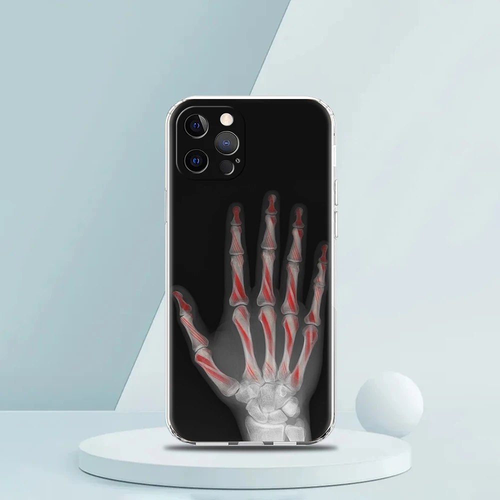 غطاء هاتف شفاف لهاتف iPhone 16,15,14,13,12,11,Pro,Max,8,7,Plus,16E,XS,Max Soft TPU Shell Autumu X Ray حقيبة عظام اليد