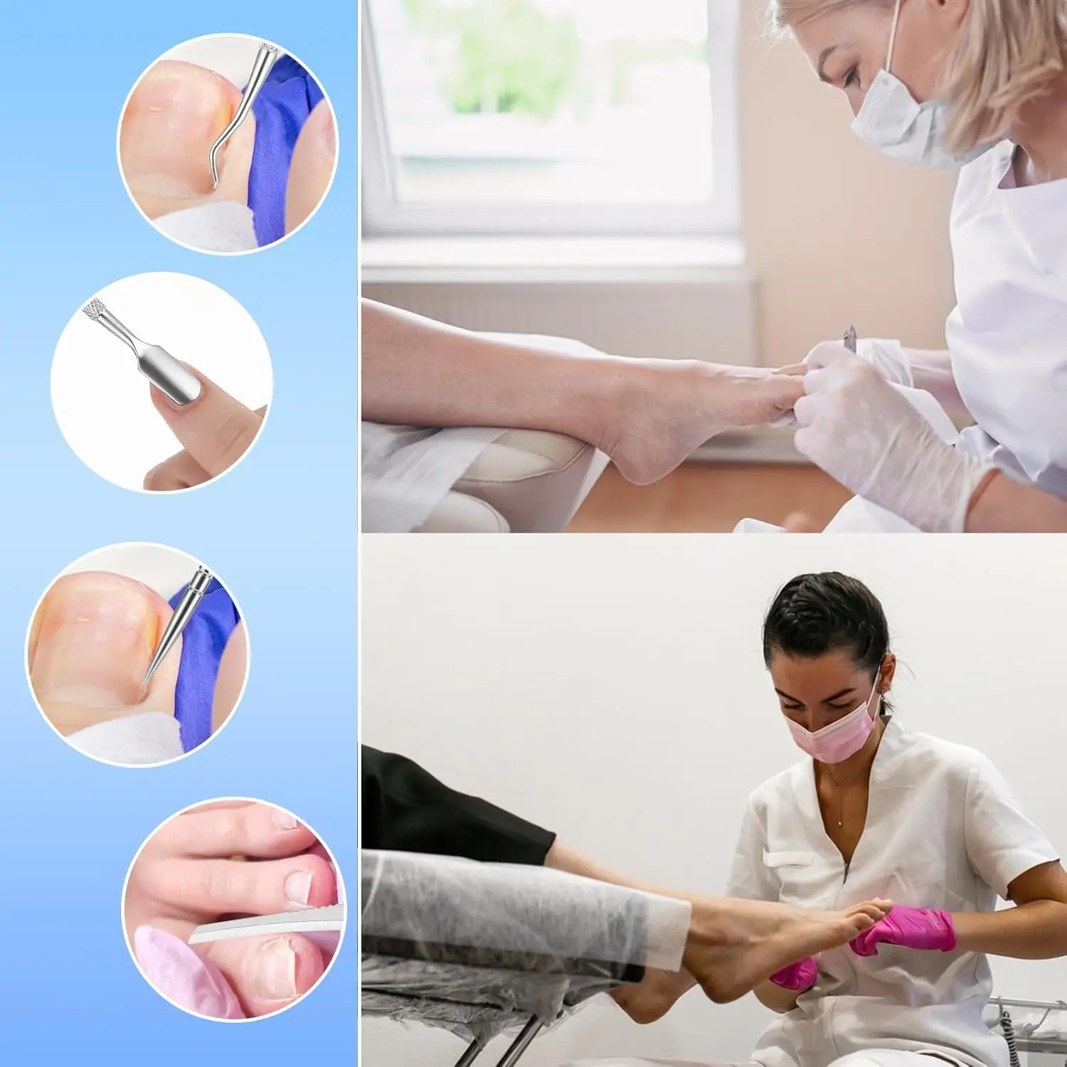 6pcs คุด Toenail เครื่องมือคุด Toenail Treatment Professional สแตนเลสสตีลภายใต้เล็บเครื่องมือทําความสะอาดบรรเทาอาการปวด