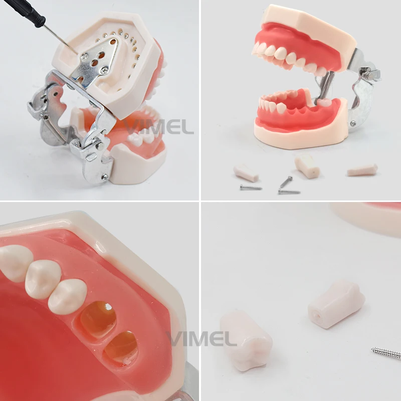 28/32 szt. Zębów Model nauczania dentystyczny wyjmowany Model zębów treningowy typodontów