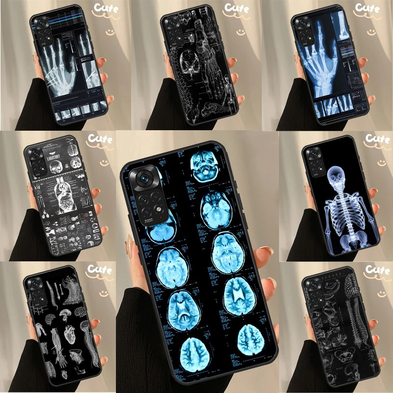 Radiological Human … - image