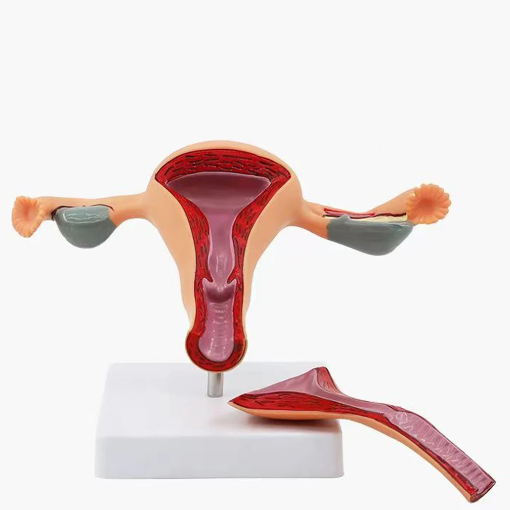 High Quality Human Female Uterus Ovary Disease Dissection Pathology Model Biology Teaching Aids Anatomy Lesion Uterus Dropship