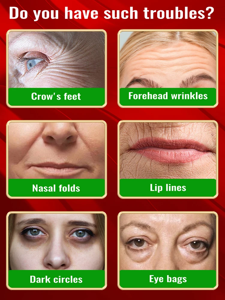 TODAS As Rugas desaparecem, 20 anos mais jovens.