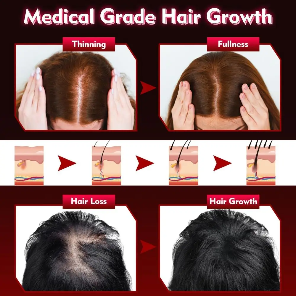 Gorro láser para el crecimiento del cabello, terapia de luz roja, resultados rápidos, tratamiento para la pérdida de cabello, fácil de usar