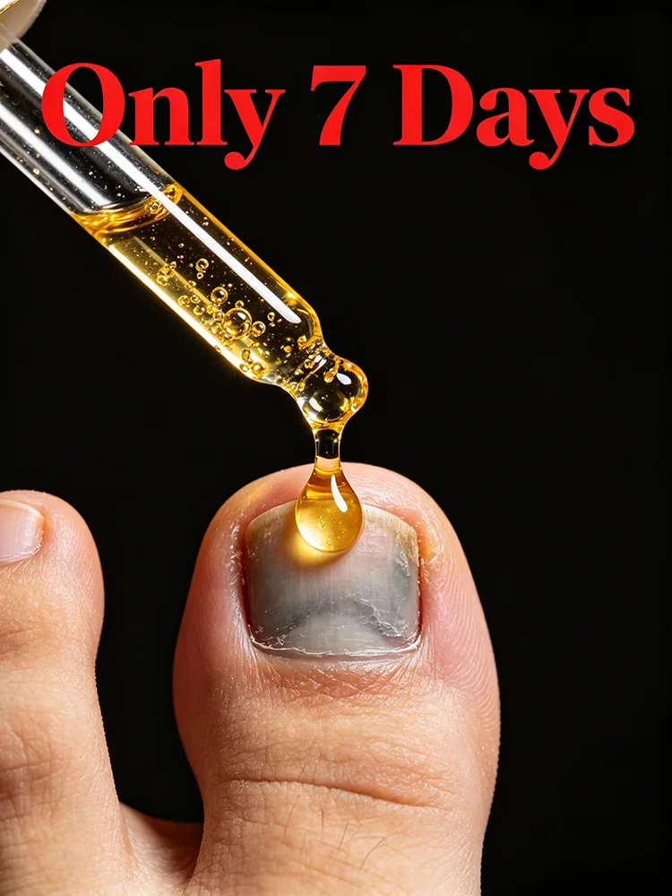 Solve nail problems, natural plant extracts, safe and gentle, no recurrence - 2026 best-selling product