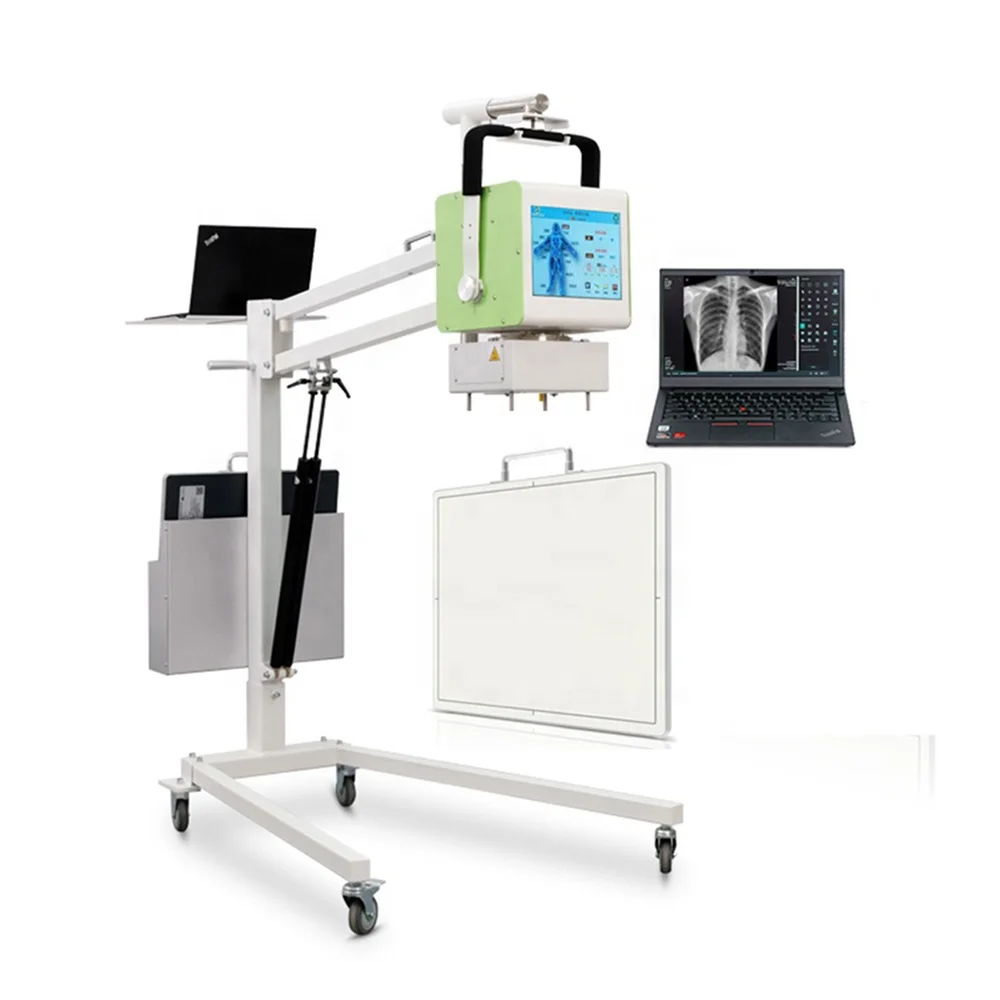 

100mA Xray DR 5kW X-ray Unit Medical Radiology Equipment Mobile Digital Portable X Ray Machine