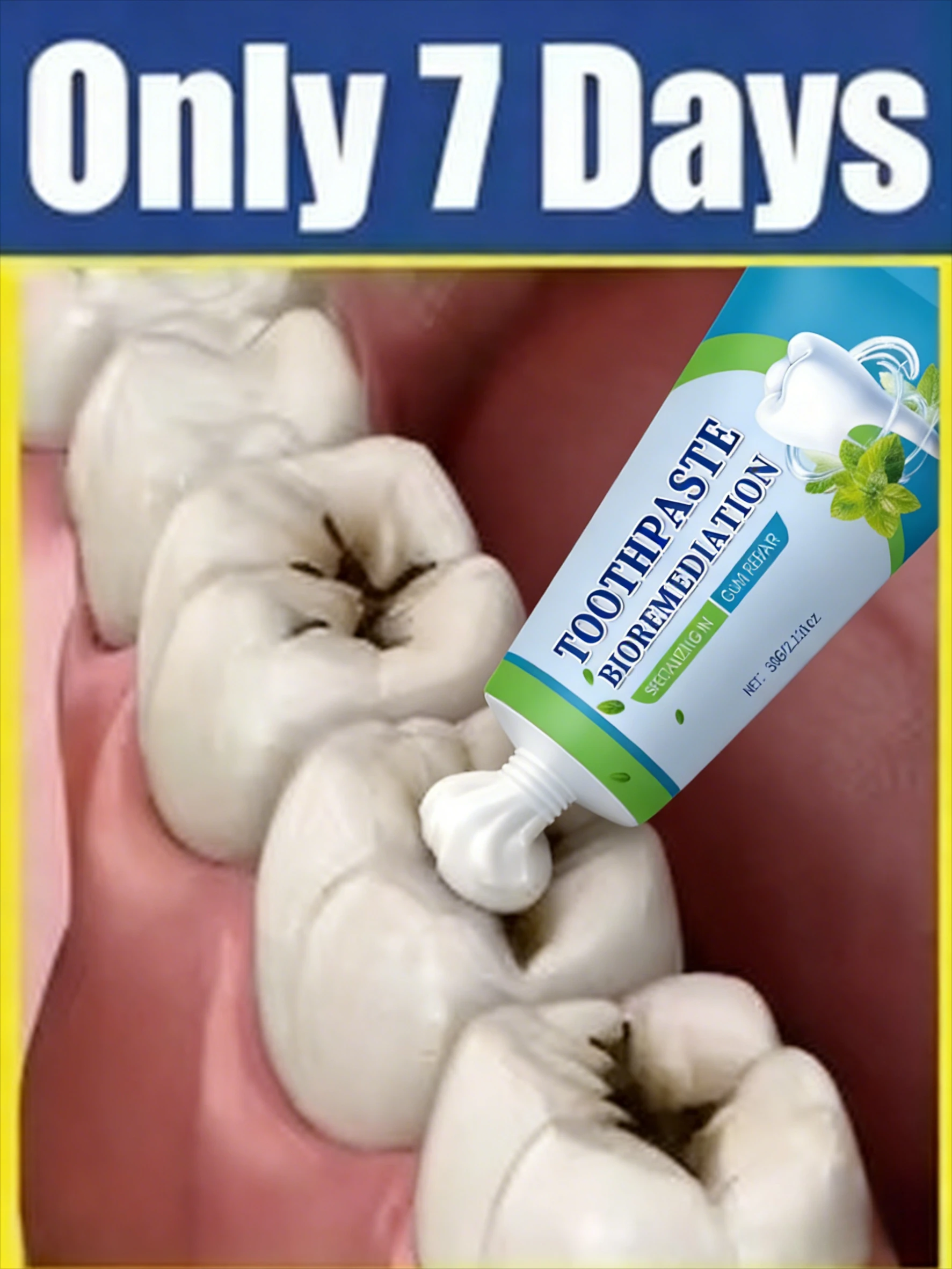 3rd Generation Upgraded Tooth Repair Tooth Root Quickly Clears Oral Bacteria