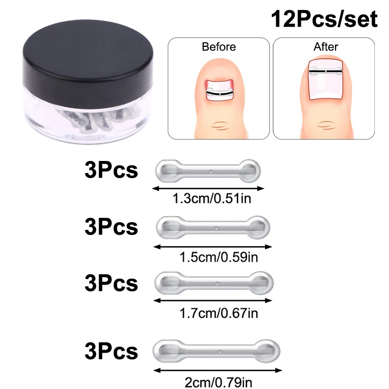 

12Pcs Ingrown Toenail Treatment Kit With 4 Multi-Sizes,Titanium Alloy Ingrown Nail Corrector Tools For Curved Toenail Corrector