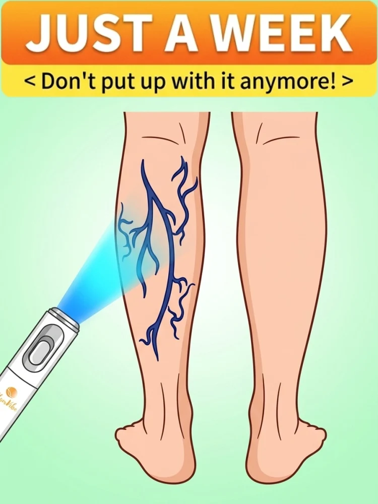 People who sit or stand for long periods should pay attention to the blood vessels in their legs.