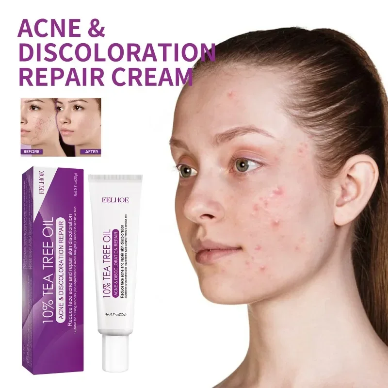 

Fade spots acne marks whitening cream remove Dark spots Freckles Repair dullness melanin moisturizing firming brightening cream