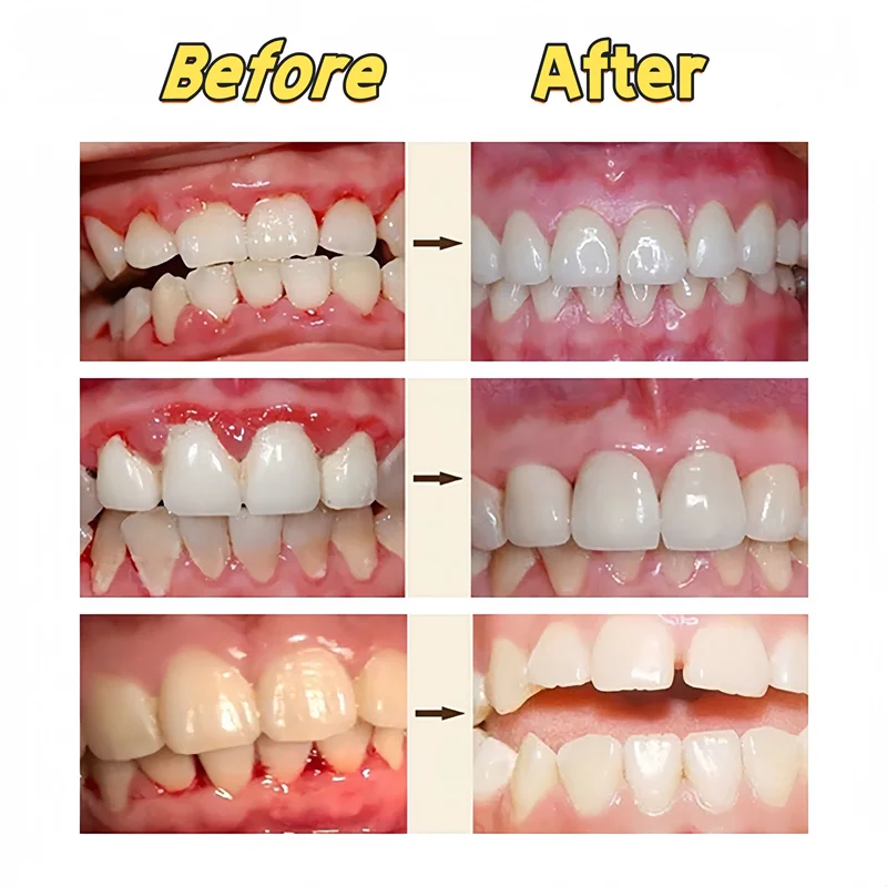 

Rapid Repair Gums Serum Effectively Relieve Tooth Allergy Dental Caries Tooth Cleaning Toothpaste Relieve Tooth Damage Drops New