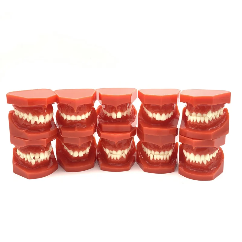 

YTYIN Orthodontic Teeth Model For Malocclusions Classification In Medical Science Teaching