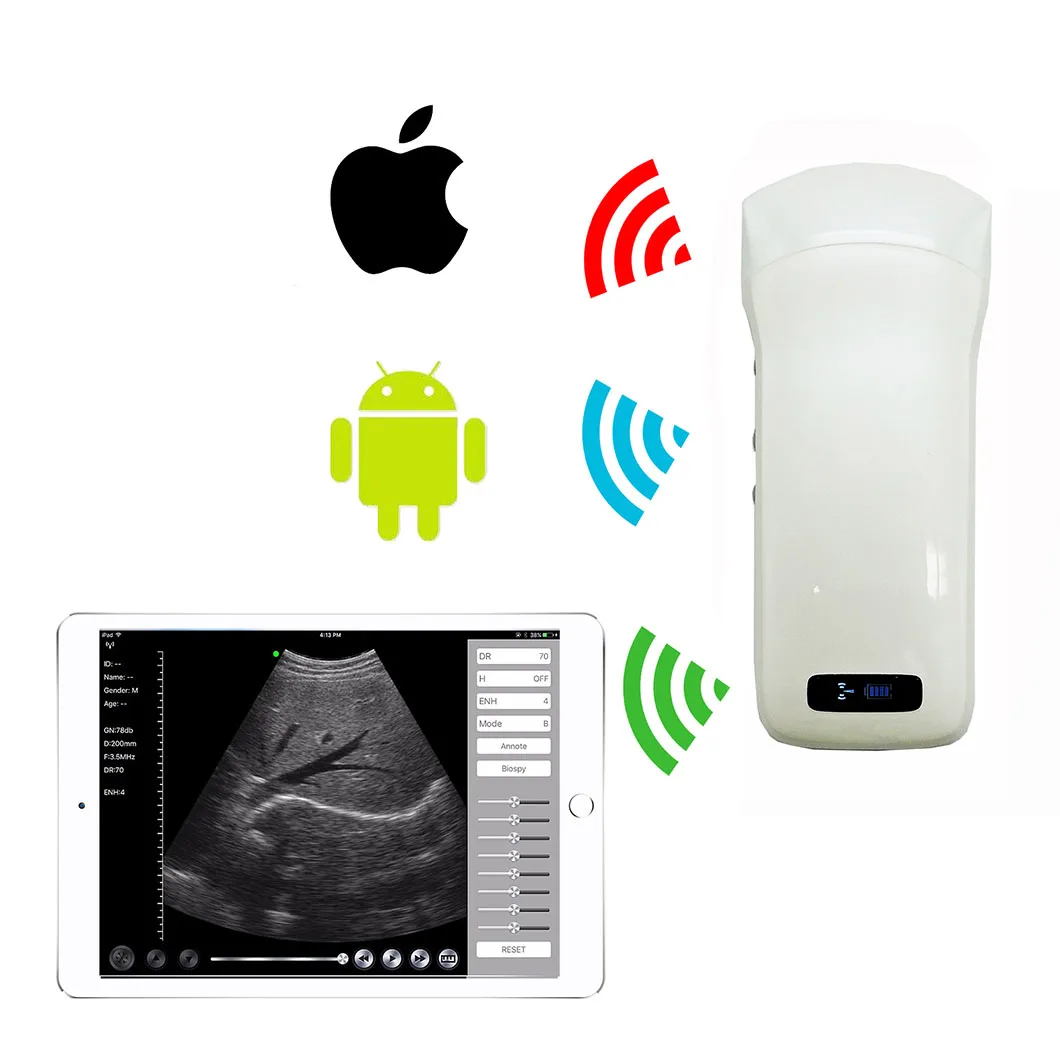 

Medical Portable 128 Elements Color Doppler WiFi Handheld Ultrasound Wireless Probe