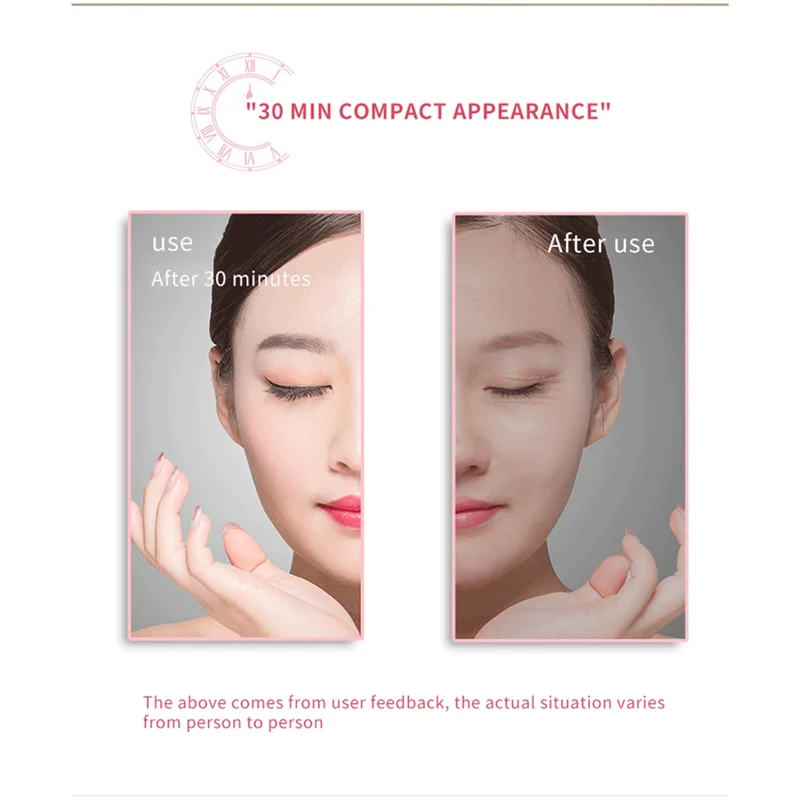 A75X Top RF คอ Face อุปกรณ์ความงาม EMS ยกคอริ้วรอย Remover LED Photon Therapy กระชับผิวต่อต้านริ้วรอยผิวอุปกรณ์