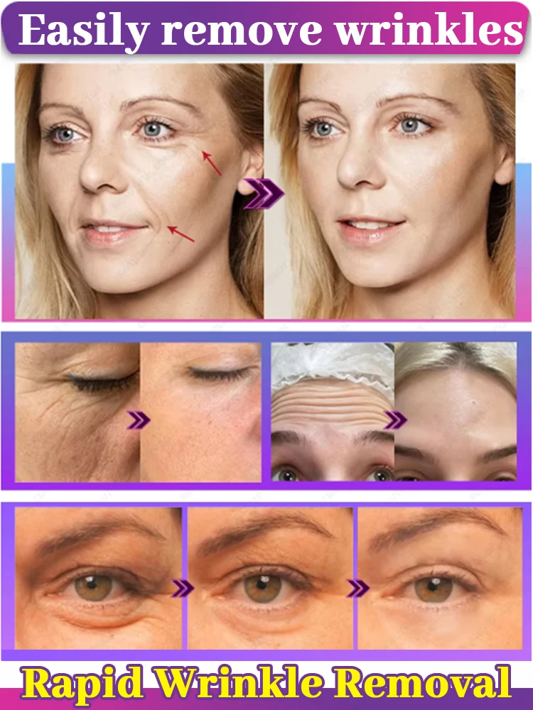 ไม่มีริ้วรอย อายุน้อยกว่า 20 ปี หน้าเต็มตัว