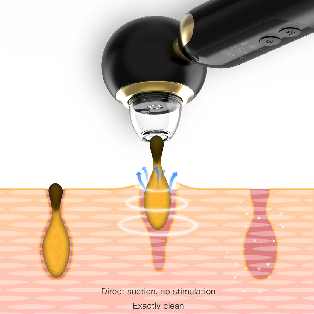 Hot & Cold Electric Vacuum Blackhead Remover Dark Spot Removal Device Beauty Products for Women