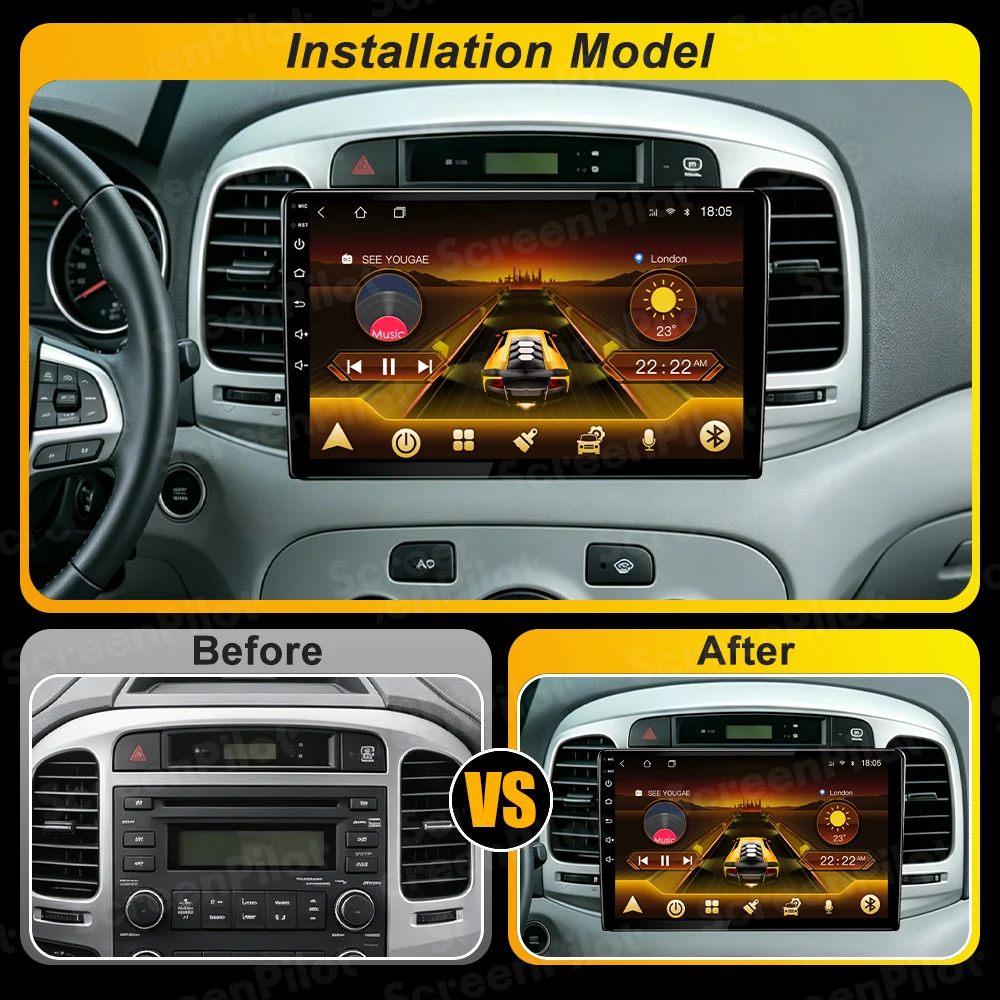 Android 16 For Hyundai Accent 3 2006 - 2011 Car Radio Stereo Head Unit Multimedia Video Player GPS Navigation 2K QLED 9 Inch 5G