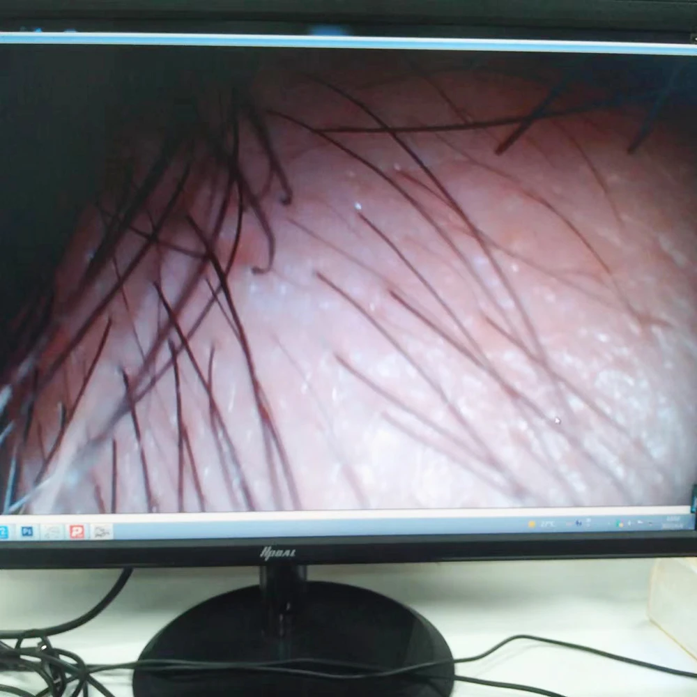 Гибкий видео 3,5 мм, 4 шт., светодиодный модуль эндоскопической камеры, USB OCHSA10, длина кабеля 2 метра