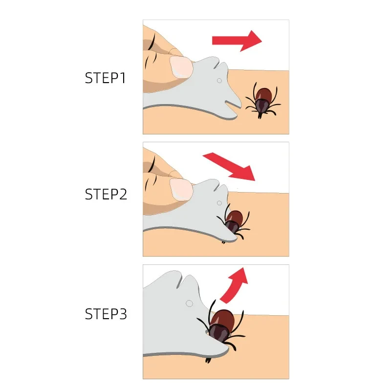 Pet Tick Removal Card with Magnifying Glass Tick Removal Tool Set Pet Flea Tick Remover For Cat Dog Pet Cleaning Supplies