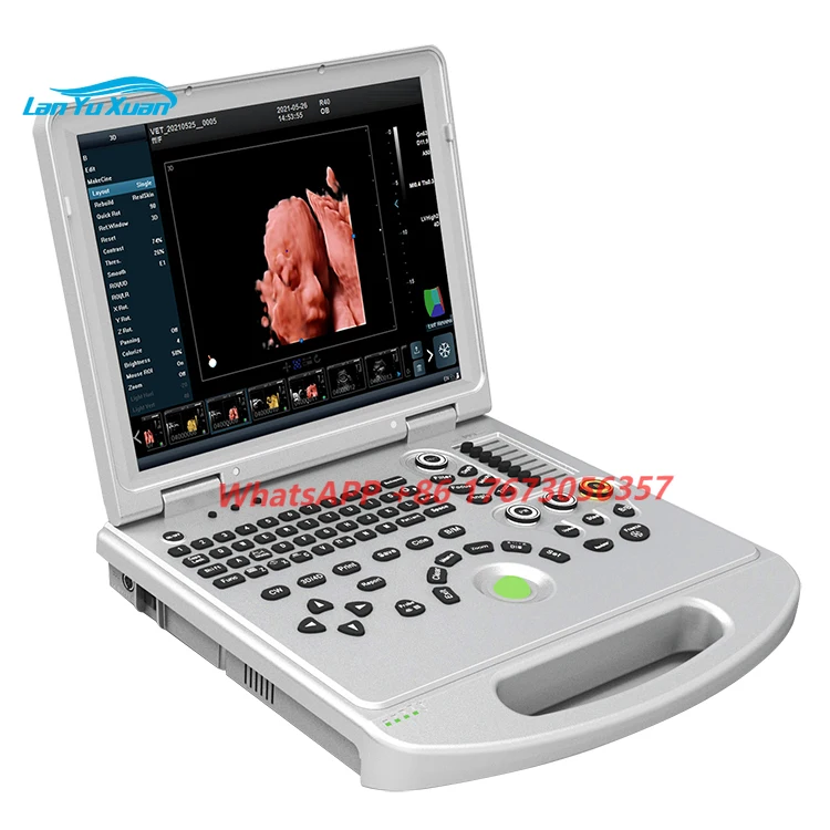 

CE Approved Hot Sale 5D Ultrasound 3D 4D Color Doppler Diagnostic System Machine Portable Ultrasound Machine