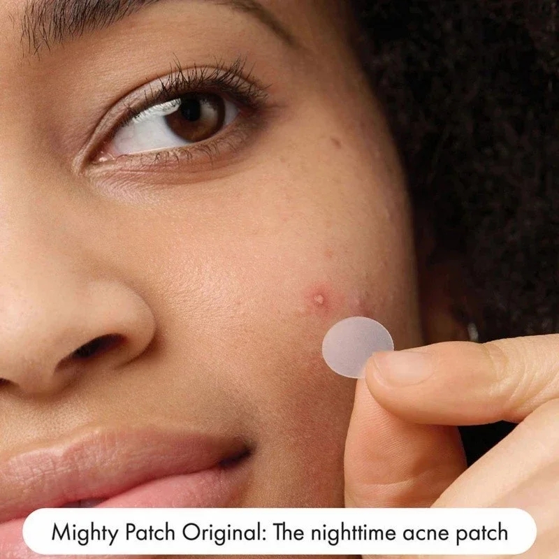 Mighty Patch Original Adesivo para Acne, Adesivos Hidrocoloides para Espinhas no Rosto, Adesivos Noturnos para Manchas na Pele do Rosto em 1 Aplicação