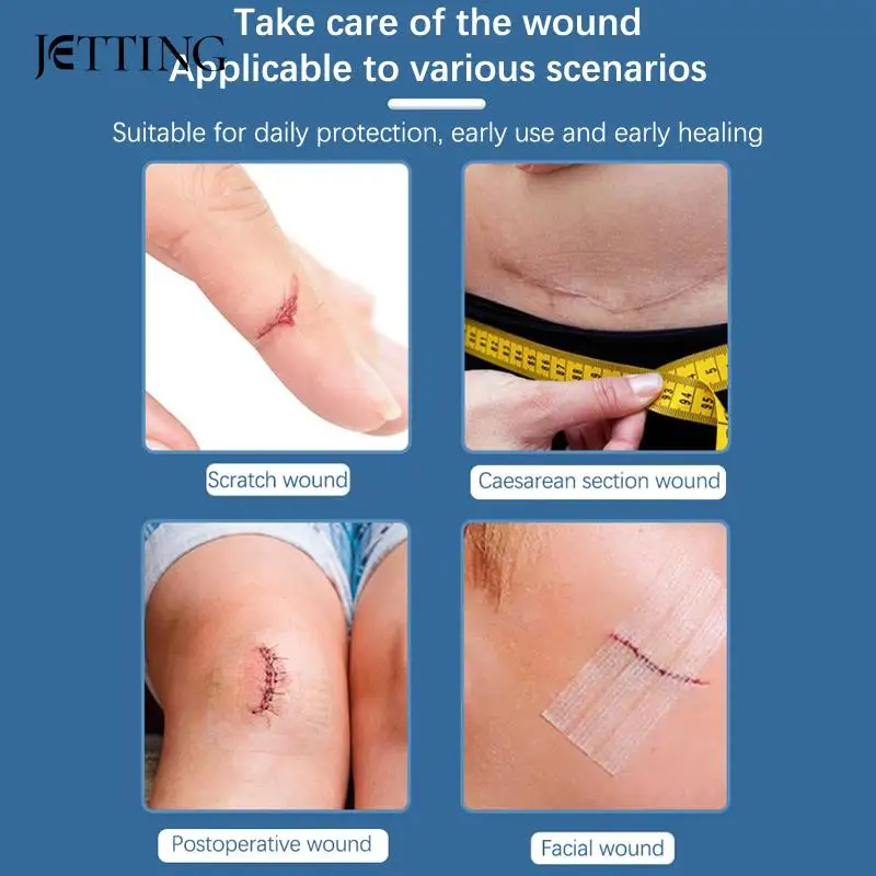 Wound Skin Closure Strips Postpartum Wound Repair Cosmetic Surgery Steri Strip Adhesive Medical Suture Free Surgical Tape