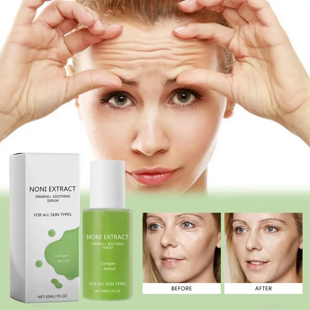 30 мл фруктовая сыворотка Noni Extract сыворотка для лица Noni Energy успокаивающая корейские типы увлажняющего средства для кожи ампула все увлажняющие Se X3V4