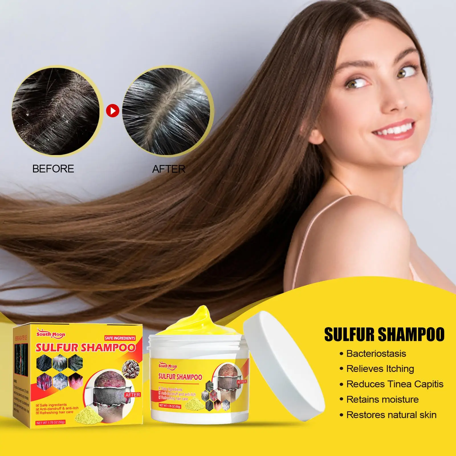 Sulfur Shampoo Remove Lice Mites Dandruff Itching Oil Control Deep Scalp Nourishi Antipruritic Care Follicles Hair Cleaning U7Z6