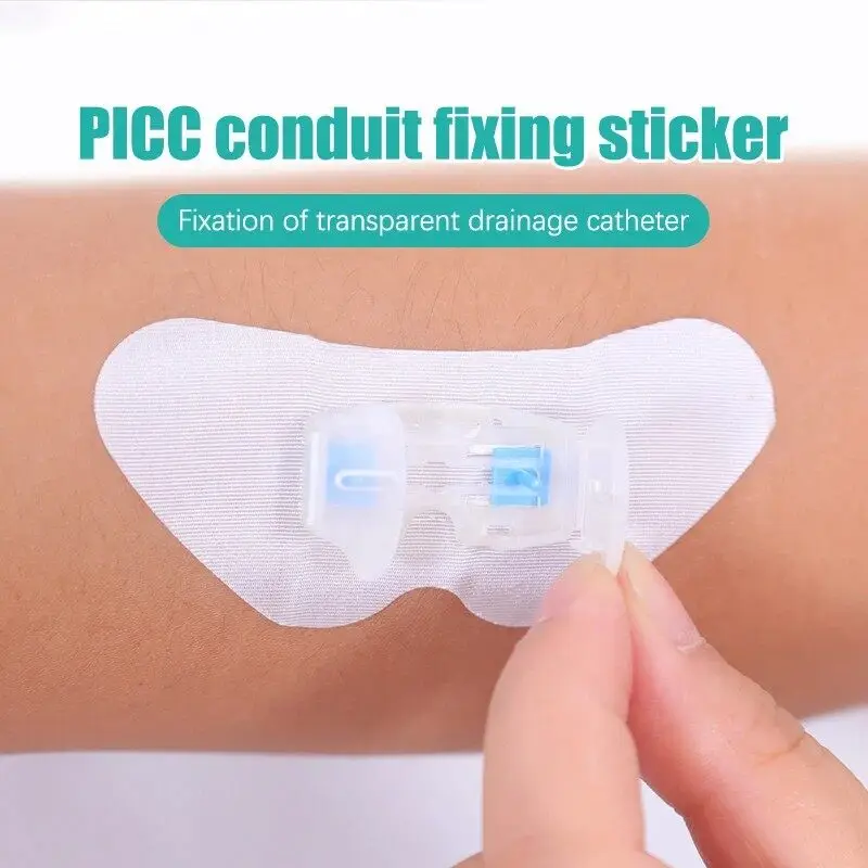 1ชิ้นตัวยึดสายสวนสำหรับ PICC และท่อระบายน้ำที่จับยึดขนาดกลางสำหรับหลอดให้อาหารในกระเพาะอาหาร