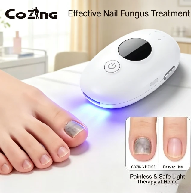 Nail Fungus Laser Treatment Device – Effectively Remove Toenail Fingernail Fungus, Onychomycosis Therapy Cure Machine Repair