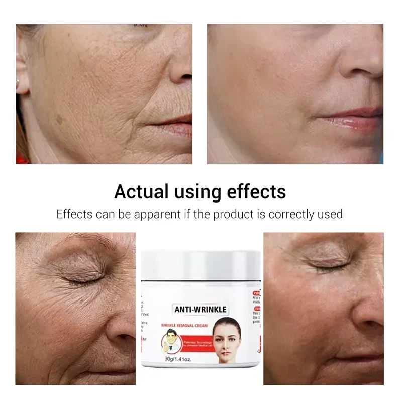 Instant Anti Wrinkle Aging Effect Remove Facial Wrinkles Fade Fine Lines Firming Tightening Face Skin Care Korea Cosmetic