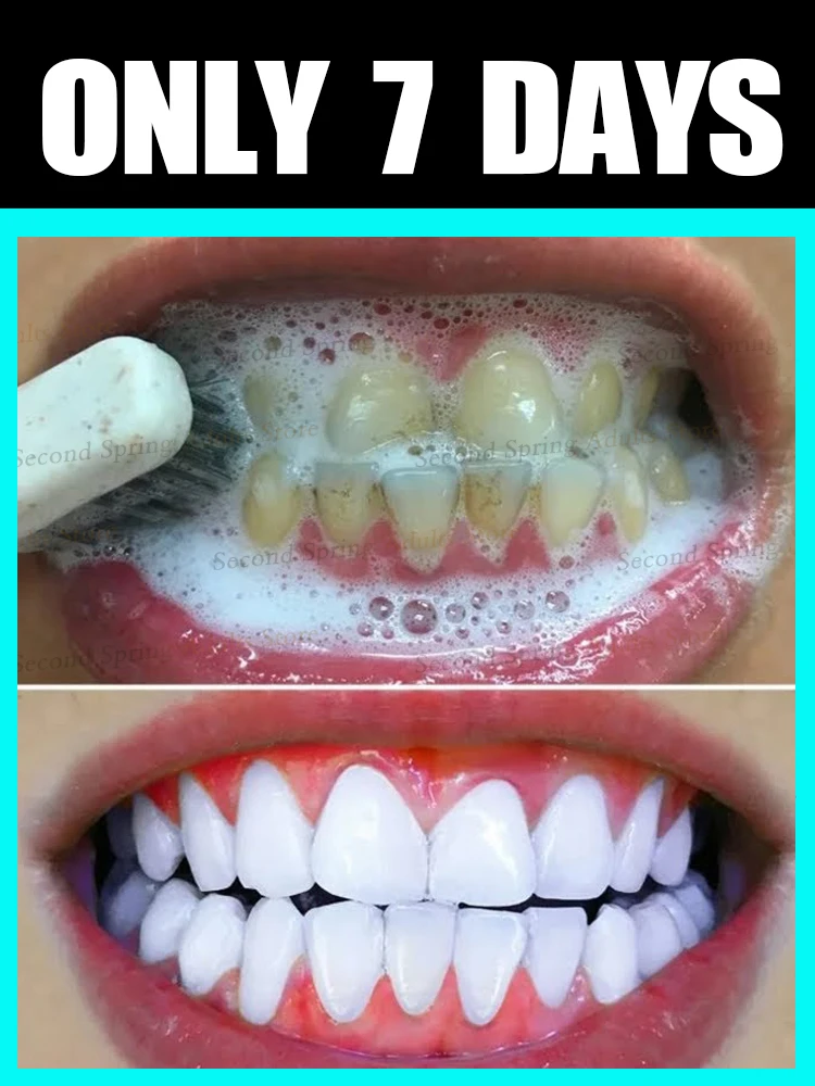 

Teeth cleaning care tools,oral foam,unisex,Free shipping