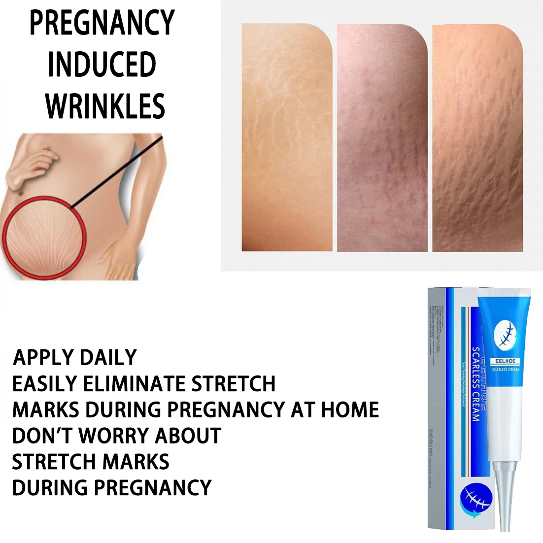 

Pregnancy wrinkles face cream anti wrinkle anti-aging maternal skin repair remove pregnancy scar treatment body skin care