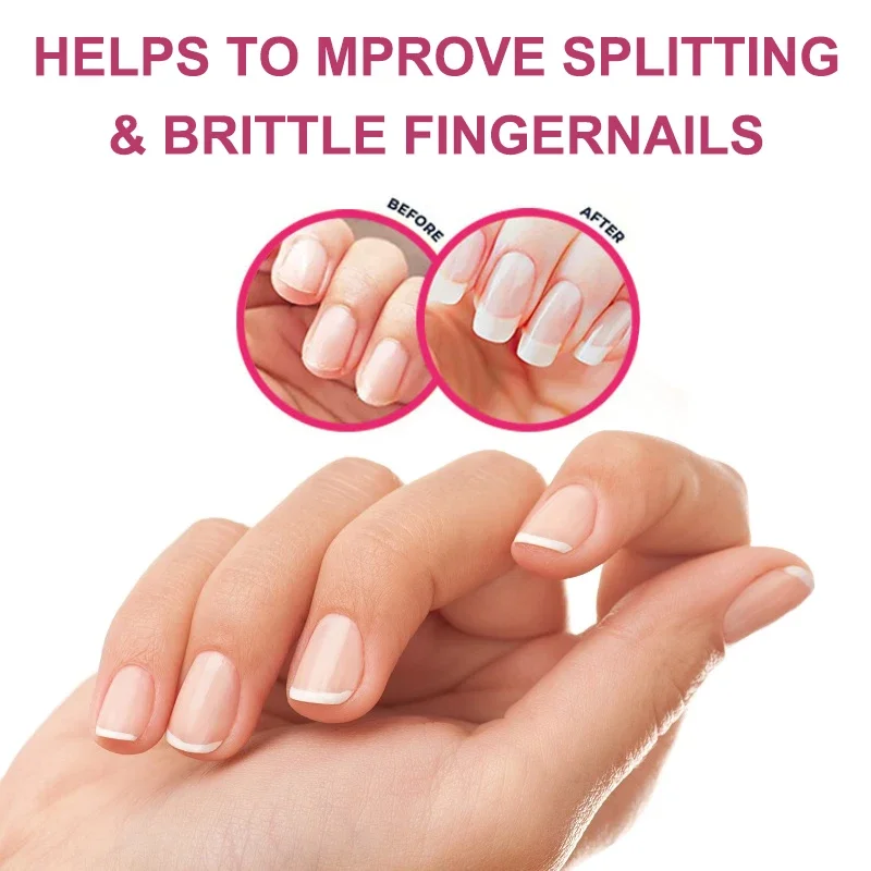 Hair, Skin & Nails Gummies | Hair Vitamins for Men and Women | Biotin SupplementsSupplements