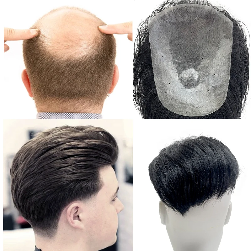 100% الشعر البشري 15*20 سنتيمتر بولي Men الرجال الطبيعية أملس الظهر نمط الشعرية الاصطناعية غطاء فعال ترقق الشعر شعر مستعار الذكور