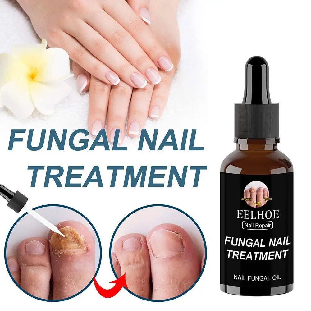 30ml/50ml Nail Nutrition Oil  Nail Treatment Cuticle Revitalizer Oil Prevent Agnail Nail Polish Nourish Skin