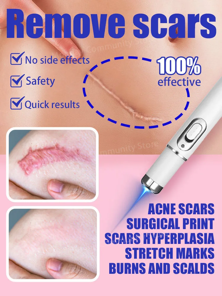 Nano-blue light penetrates quickly to remove scars.