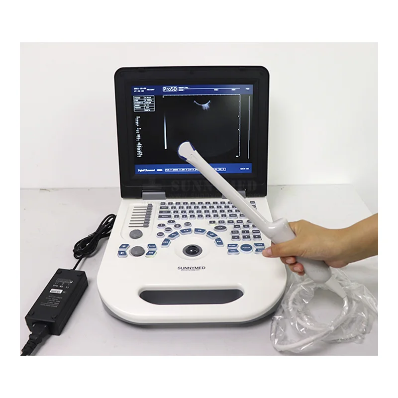 

SY-AX50 Diagnostic 12. Inch B&W Vascular Ultrasound System With Vaginal Probe