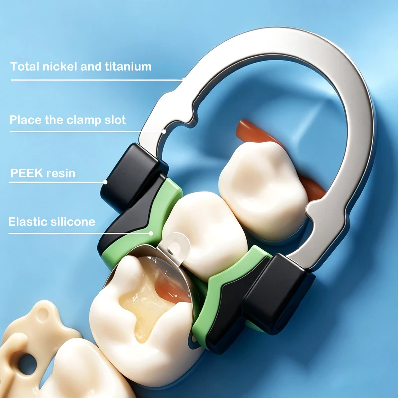 Dental Matrices Clip Ring Nickel-Titanium Alloy Elastic Clamping Ring for Premolars/Low crowns/Molar/High crown/