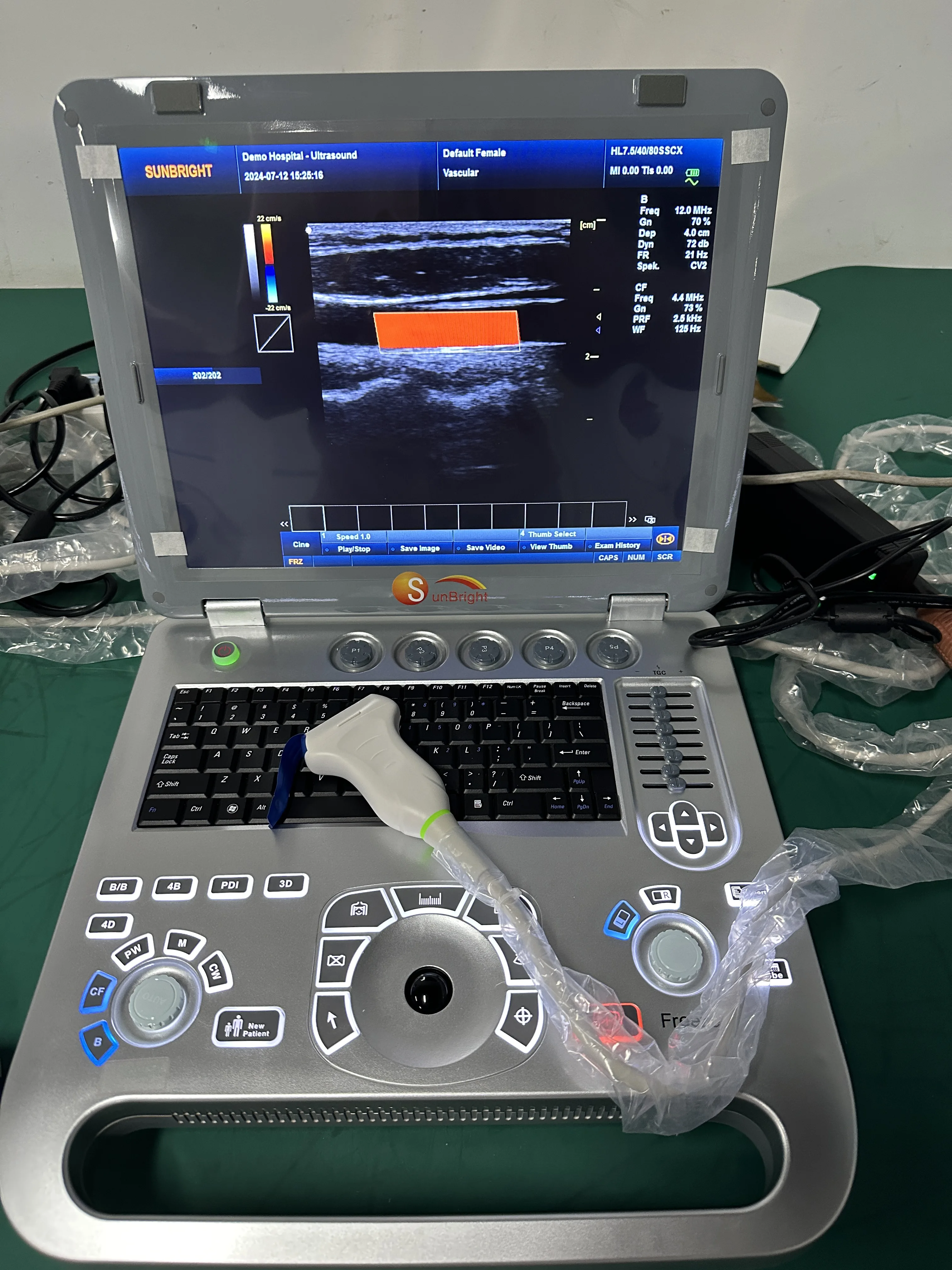 High quality ultrasound portatil veterinary ultrasound machine for hospital 4D vascular doppler echography ultrasound scanner