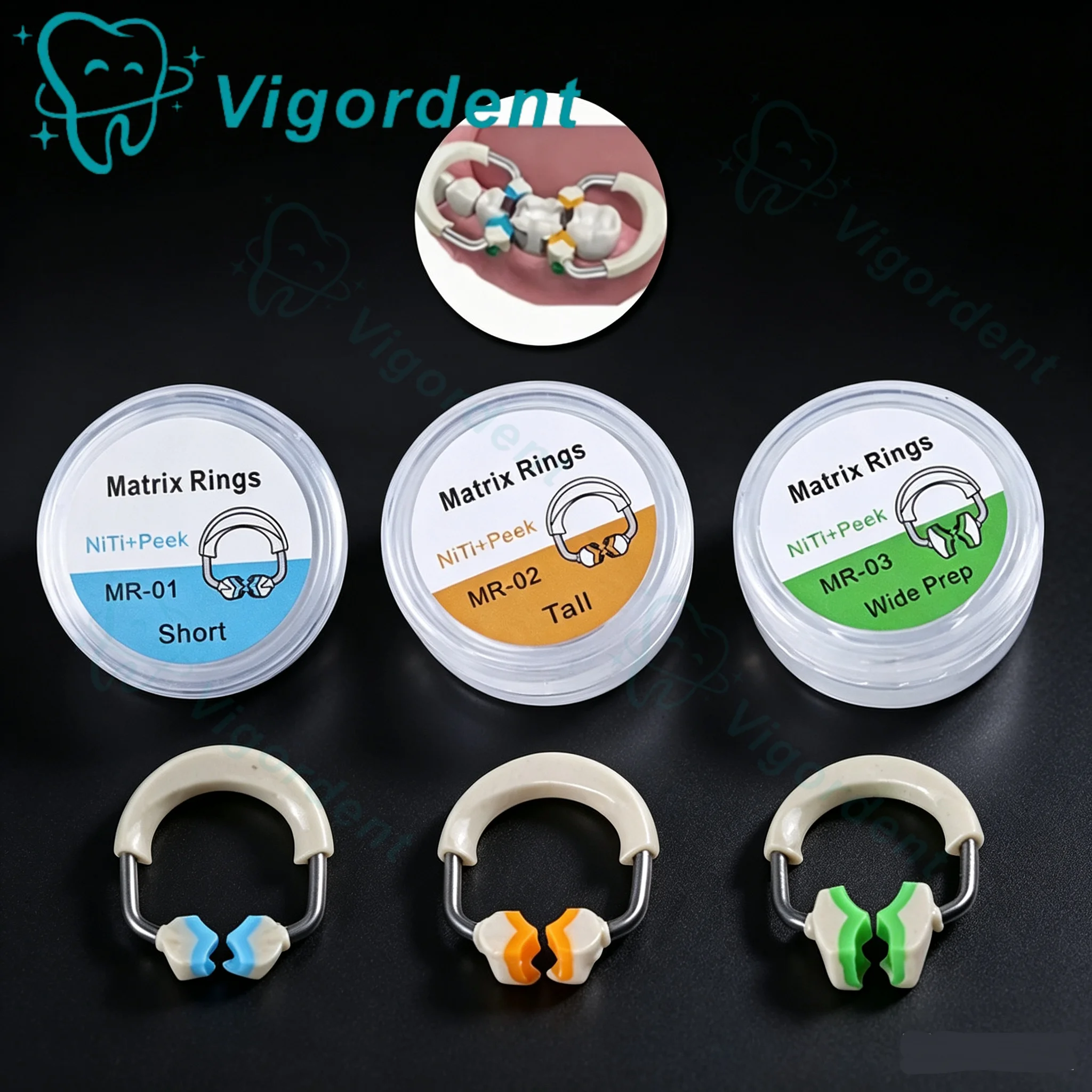 1 pièce Anneau de fixation pour matrices dentaires sectionnelles profilées NITI, type Garrison, avec forceps de placement et clips de serrage